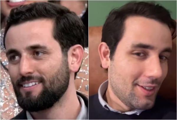 Antes e depois de Matteus Amaral (Imagem:Reprodução/Instagram)