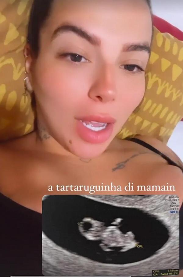  Petra mostra primeiro ultrassom.(Imagem:Reprodução/Instagram )