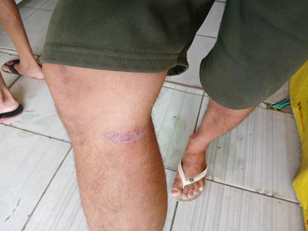 Morador denuncia perigo causado por animais soltos na PI-140 em Floriano(Imagem:FlorianoNews)