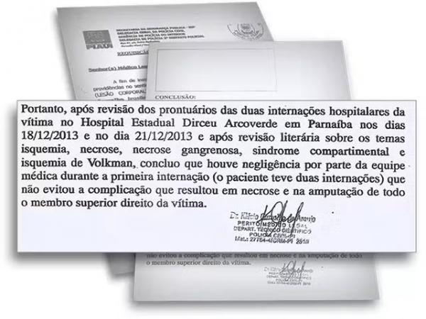 Laudo do IML conclui que houve negligência médica com garoto amputado no PI.(Imagem:Reprodução)