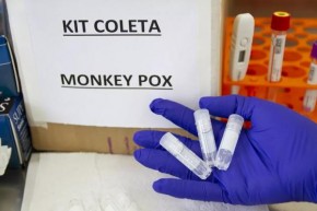 Sobe para 17 o número de casos suspeitos de varíola dos macacos no Piauí(Imagem:ADRIANA TOFFETTI)