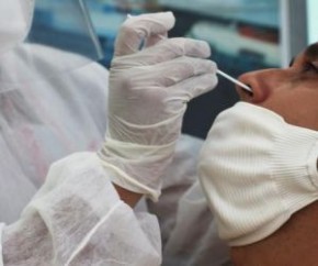 O Piauí registrou 143 casos confirmados e dois óbitos de Covid-19, segundo os dados divulgados pela Secretaria de Estado da Saúde, nesta segunda-feira (18).  Dos 143 casos confirma(Imagem:Reprodução)