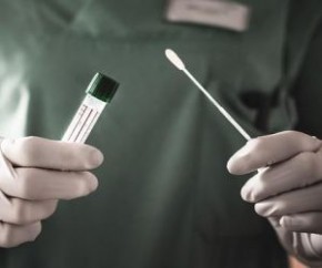 Sesapi alerta que só o exame PCR pode detectar variantes e orienta pacientes(Imagem:Reprodução)