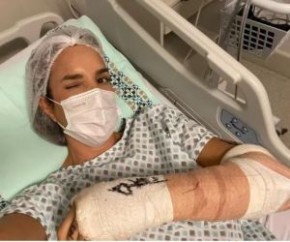 Ivete Sangalo passa por cirurgia(Imagem:Reprodução)