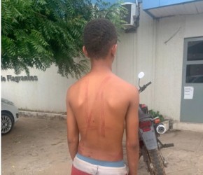 Adolescente suspeito de furtar esporas é punido com chicoteadas(Imagem:Divulgação)