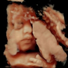 Luccas Neto mostra rosto de seu 1º filho, Luke, em ultrassom(Imagem:Reprodução)