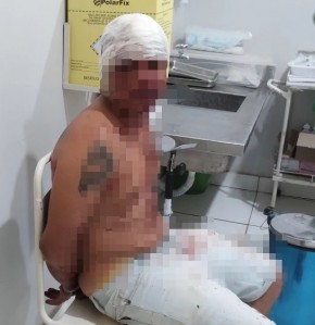 Suspeito de agredir ex-mulher é preso.(Imagem:PMPI)