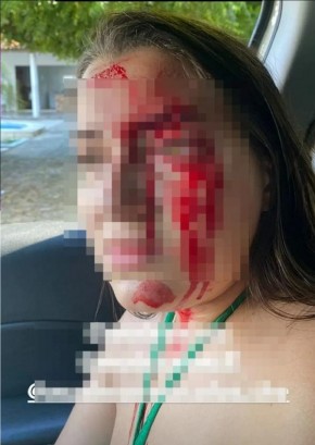 Jovem usa rede social para denunciar agressão que sofreu do namorado, em Teresina(Imagem:Reprodução)