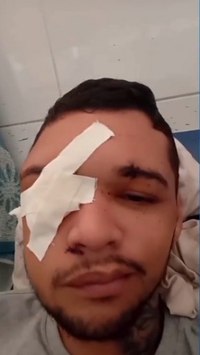 Jo&atilde;o Marcelo teve a casa invadida por criminosos e a companheira dele tamb&eacute;m foi baleada ao tentar impedir os disparos.(Imagem:Reprodu&ccedil;&atilde;o)