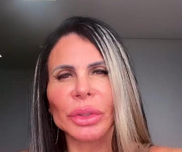 Gretchen rebate críticas após harmonização: Povinho recalcado(Imagem:Reprodução)