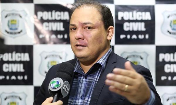 Luccy Keiko, delegado-geral da Polícia Civil do Piauí (PC-PI).(Imagem:Arquivo/Cidadeverde.com)