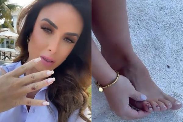 Nicole Bahls se acidenta em casa: