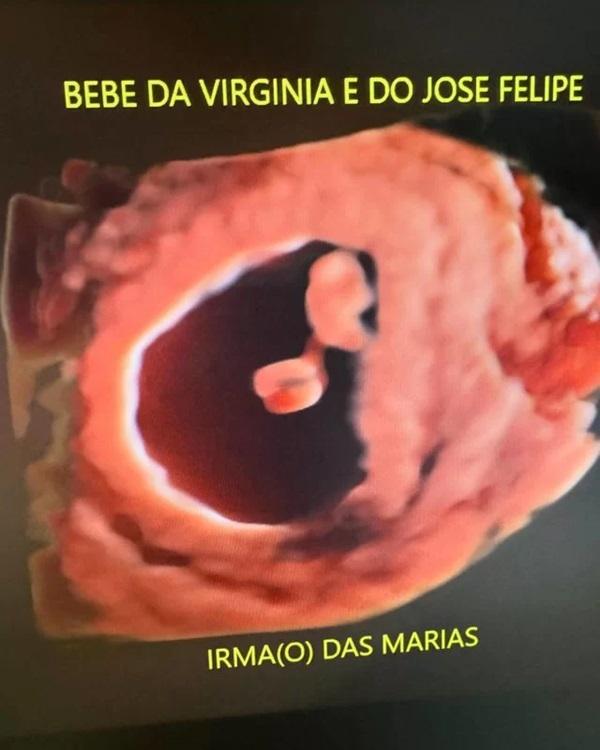 Virgínia compartilhou as primeiras imagens de ultrasson de seu terceiro filho(Imagem:Reprodução/Instagram)