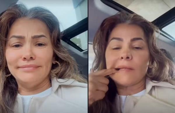 Suzana Alves relata tensões que têm vivido: atriz quebrou o dente.(Imagem:Reprodução/Instagram)