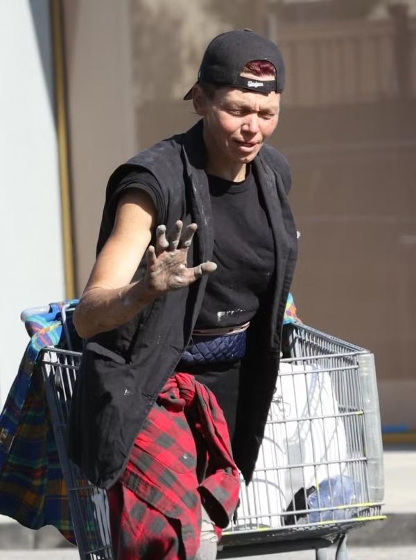 Em situação de rua, ex-modelo Loni Willison exibe dedos deformados.(Imagem:Grosby Group)