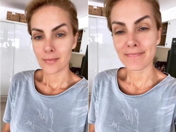 Ana Hickmann(Imagem:Reprodução/Instagram)