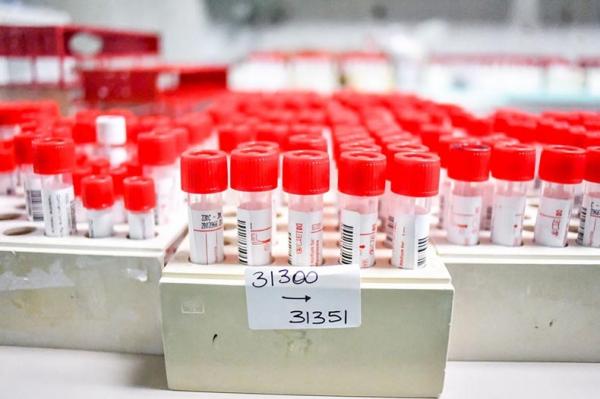 O total de casos confirmados para a varíola dos macacos no Brasil chegou a 17 registros, segundo informações do Ministério da Saúde. A pasta confirmou na sexta-feira (24) três novo(Imagem:Reprodução)