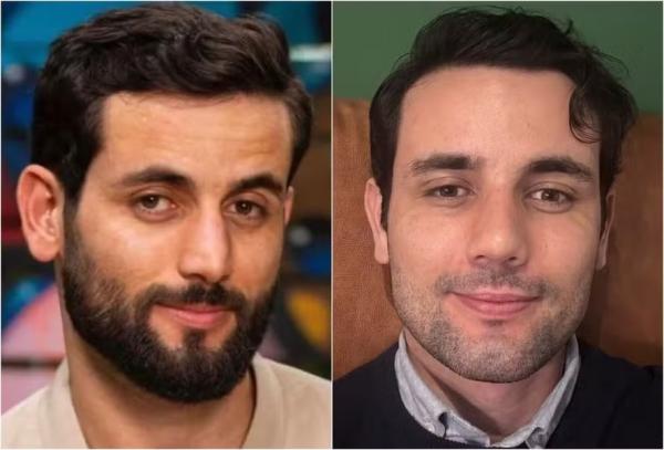 Antes e depois de Matteus Amaral(Imagem: Reprodução/Instagram)