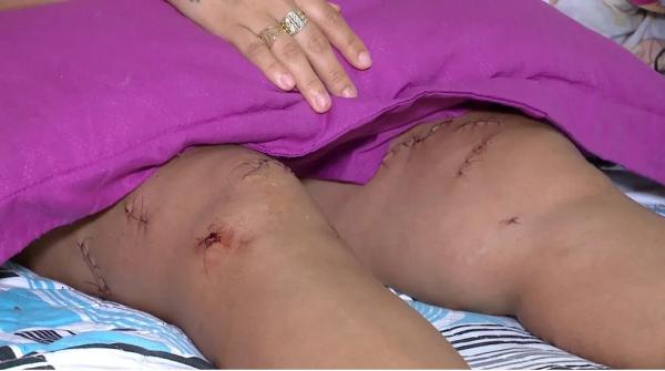 Esteticista sofreu 19 facadas pelo ex-marido, que continua foragido.(Imagem:Reprodução/TV Clube)