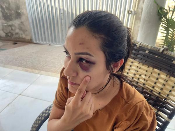 Enfermeira Carlene Nobre denuncia servidor do TJPI por violência doméstica.(Imagem:Christian Sousa /TV Clube)