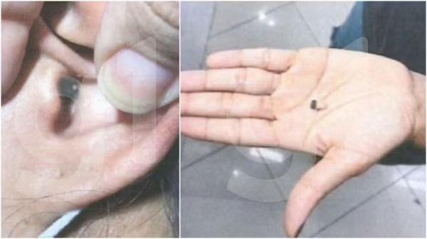 Enfermeira foi flagrada com ponto eletrônico no ouvido durante realização da prova da Polícia Civil do Ceará.(Imagem:Reprodução)