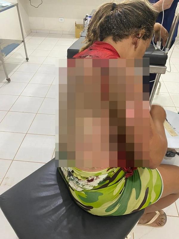 Homem é preso suspeito de atear fogo na companheira enquanto ela dormia no Piauí.(Imagem:Reprodução)