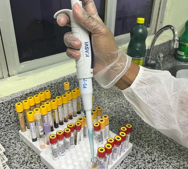 O objetivo de fortalecer sua capacidade de diagnóstico e modernizar sua estrutura laboratorial.(Imagem:Divulgação)