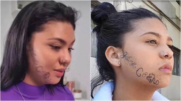 Tayane Caldas (montagem remoção da tatuagem feita à força pelo ex).(Imagem:Pedro Melo/TV Vanguarda)