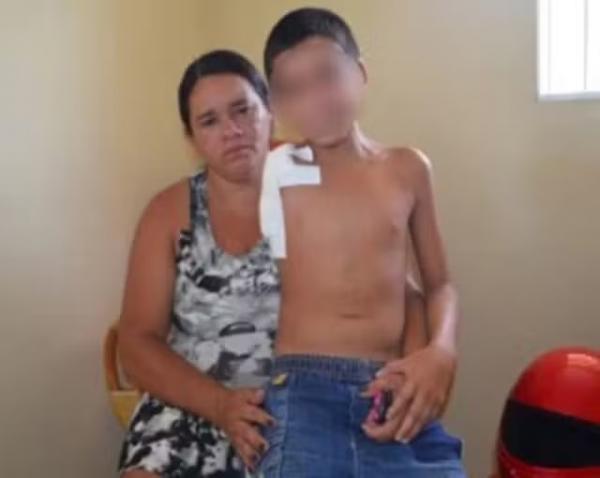 Garoto sofreu fratura exposta no braço após cair de cavalo no CE.(Imagem:Tacyane Machado)