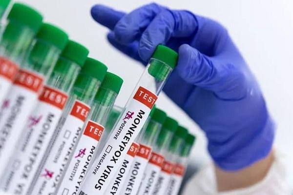Amostras para testes de varíola dos macacos.(Imagem:Agência Brasil/Diulgação)