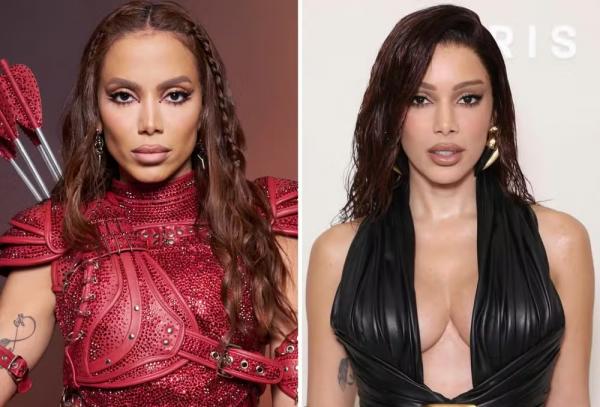Antes e depois de Anitta (Imagem: Reprodução/Instagram)