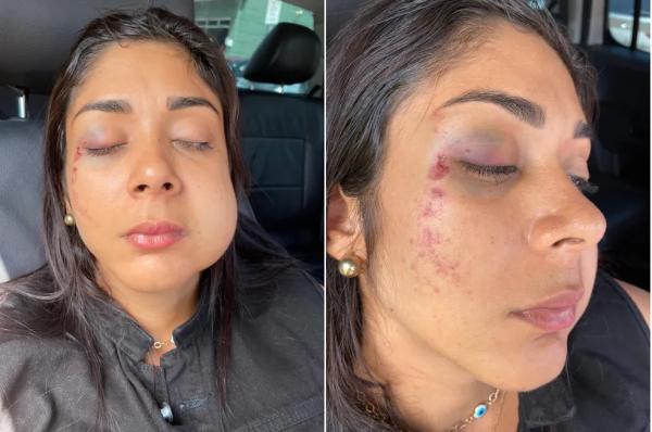 Empresária desmaia após ser agredida por ex-namorado de amiga com soco no rosto(Imagem:Reprodução)