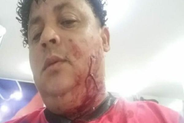 Músico é esfaqueado no rosto durante assalto na cidade de Parnaíba(Imagem:Reprodução)
