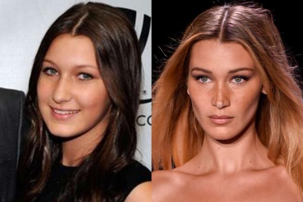 Yolanda Hadid, mãe da modelo Bella Hadid, está sendo alvo de ataques e críticas na internet. O empresária se tornou alvo quando a jovem revelar que ganhou a permissão para uma rino(Imagem:Reprodução)