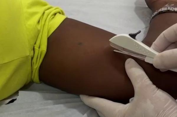 Floriano avan&ccedil;a na oferta de DIU e Implanon e amplia acesso da popula&ccedil;&atilde;o &agrave; pol&iacute;tica p&uacute;blica.(Imagem:Secom)