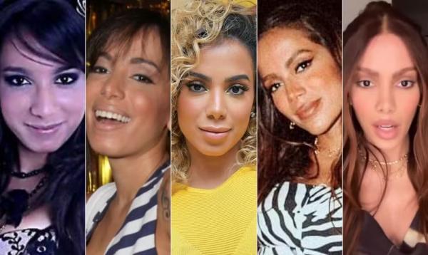 Antes e depois de Anitta: as várias transformações no rosto da cantora ao longo do tempo.(Imagem: Reprodução/Instagram)