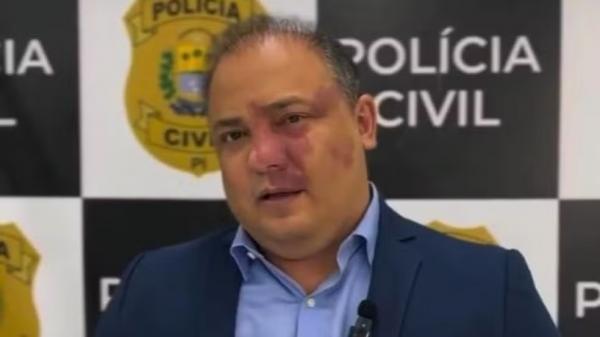 Delegado-geral da Polícia Civil do Piauí, Luccy Keiko.(Imagem:Reprodução)