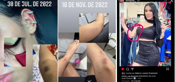 Ex-mulher de MC Dricka mostra agressões após fazer BO.(Imagem:Reprodução/Instagram)