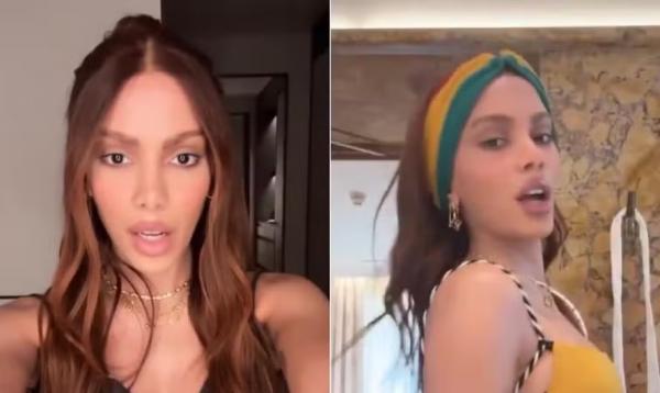 A cantora Anitta, após novo procedimento estético no rosto.(Imagem:Reprodução/X)