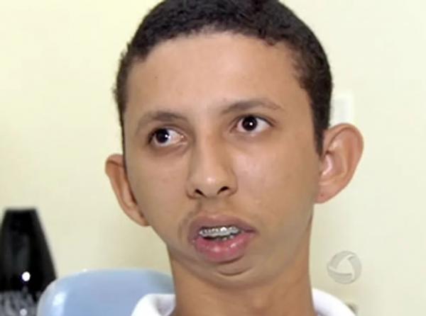  Luiz nasceu de parto normal e o médico teria utilizado um 