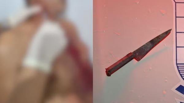 Homem &eacute; esfaqueado no pesco&ccedil;o e se recusa a denunciar companheira suspeita no interior do Piau&iacute;.(Imagem:Montagem g1/Divulga&ccedil;&atilde;o/PMPI)