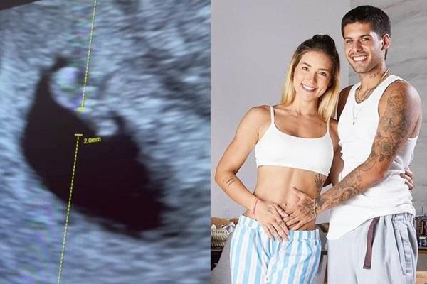 Grávida de seu terceiro filho com Zé Felipe, Virginia Fonseca utilizou as redes sociais para mostrar imagens de ultrassom do bebê(Imagem:Reprodução/Instagram)