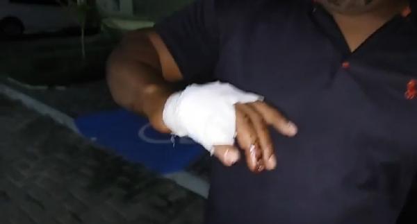 Ivanildo foi lesionado durante a discussão(Imagem:Reprodução/JC24horas)