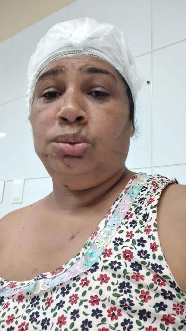  Guilhermina internada em hospital após a tentativa de feminicídio.(Imagem:Arquivo Pessoal )