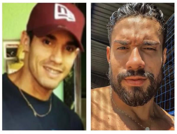  Bil Araújo antes e depois da harmonização facial.(Imagem:Reprodução)