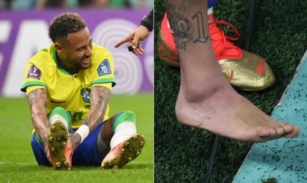 Neymar Jr está fora de próximos jogos do Brasil na Copa do Mundo do Catar.(Imagem:AFP)