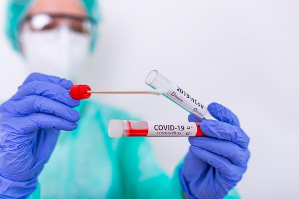 A sequência de queda dos casos de Covid-19 em Teresina foi interrompida na última semana. O painel epidemiológico da Fundação Municipal de Saúde mostra que os atendimentos por sínd(Imagem:Reprodução)