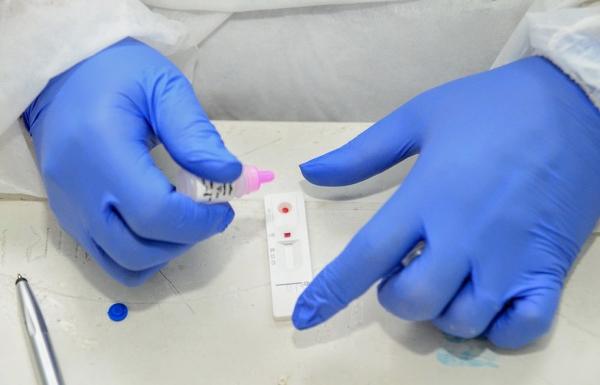 Positividade de testes da covid volta a subir e associação de medicina faz alerta