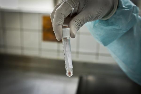 Piauí registra 685 casos de Covid-19 e 3 óbitos pela doença nas últimas 24 horas