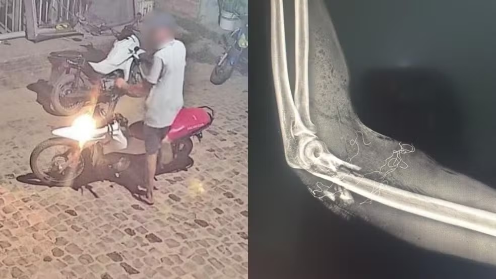 Jovem de 18 anos é baleado no braço enquanto trabalhava em pizzaria no PI
